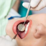 oral hyginen